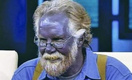 Самолечение сделало мужчину фиолетовым (видео)