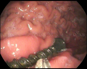 Источник: ОДКБ 56 (Юлия Шарифуллина) / t.me