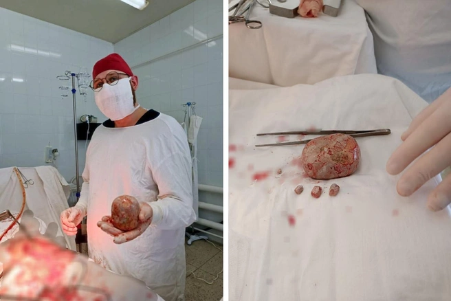 Оперировал пациента врач Богдан Самсонов | Источник: ГУЗ СО «Балаковская городская клиническая больница» / Telegram