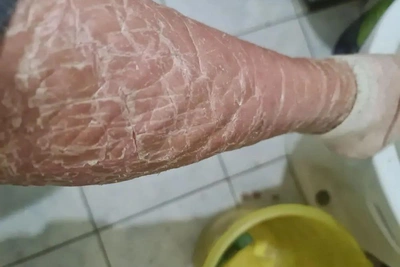 Таксист отказался везти женщину с больной кожей