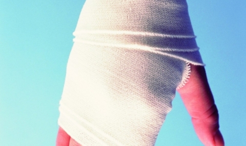 В Израиле врачи спасли обоженные пальцы девушки, вшив их ей в живот