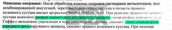 Врачи опровергли информацию о том, что гимнастке Лале Крамаренко по ошибке удалили здоровый мениск