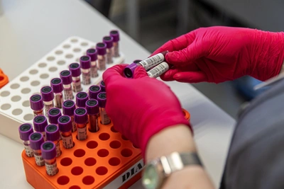 Free Izhevsk check-up offers fluorography and blood tests