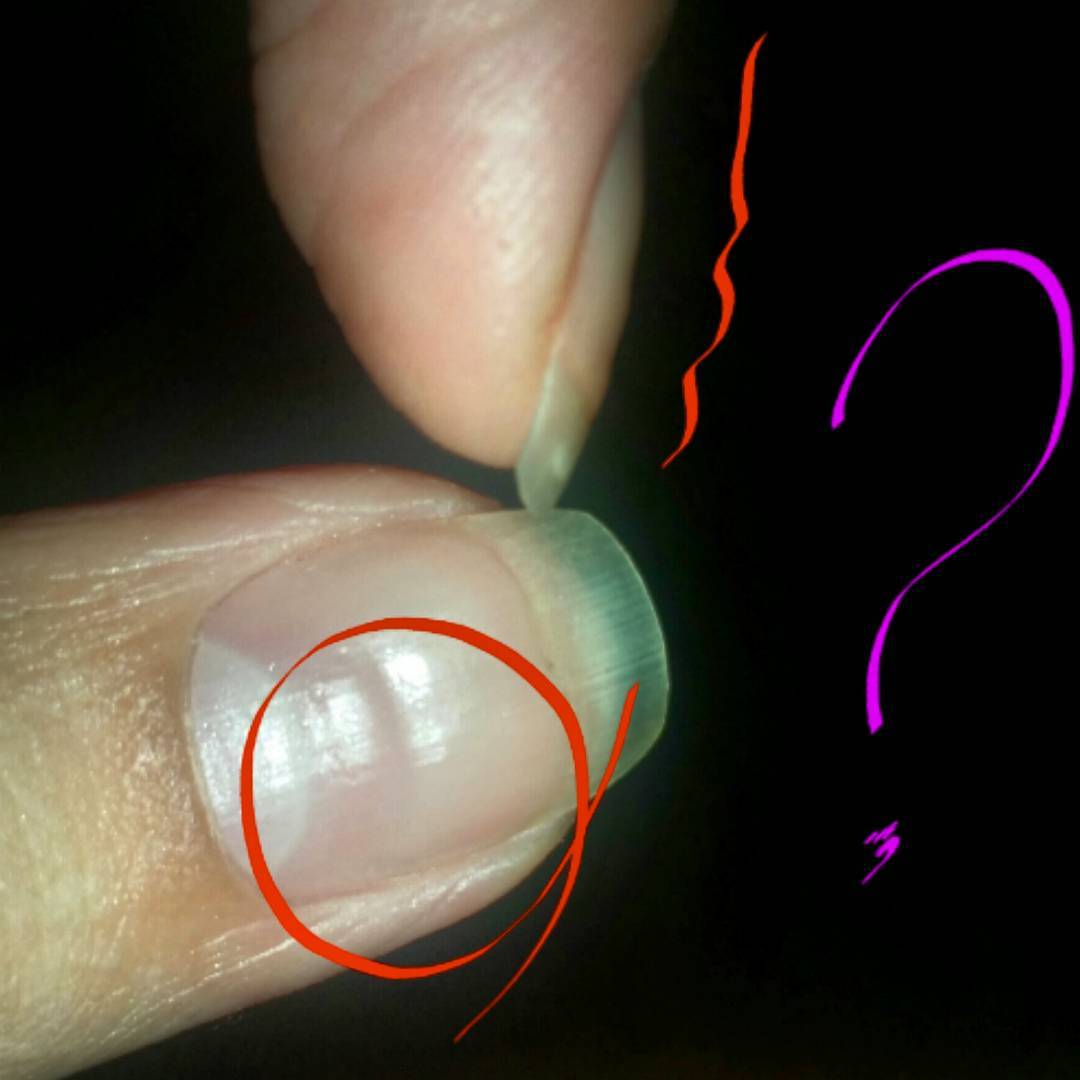 20 причин, по которым у вас на ногтях могут быть продольные полосы или бороздки