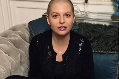 Margarita Simonyan reveals wigless look after breast cancer chemo