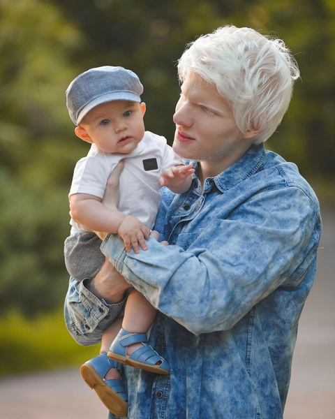 Генетическая лотерея: как выглядит ребенок самого красивого альбиноса и грузинской модели