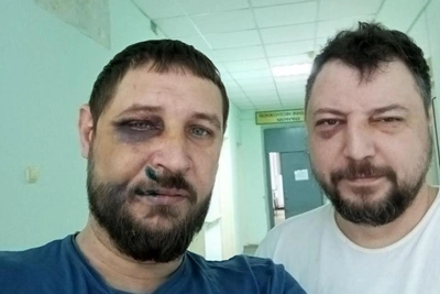 В Екатеринбурге избили двух репортеров