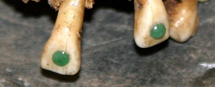 Гарантия — тысяча лет: уровень стоматологии у древних майя восхитил археологов