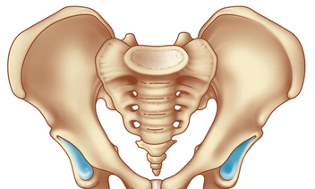 Болит подвздошная кость: вероятные причины