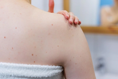 Воронежские ученые создали электронный нос для выявления рака