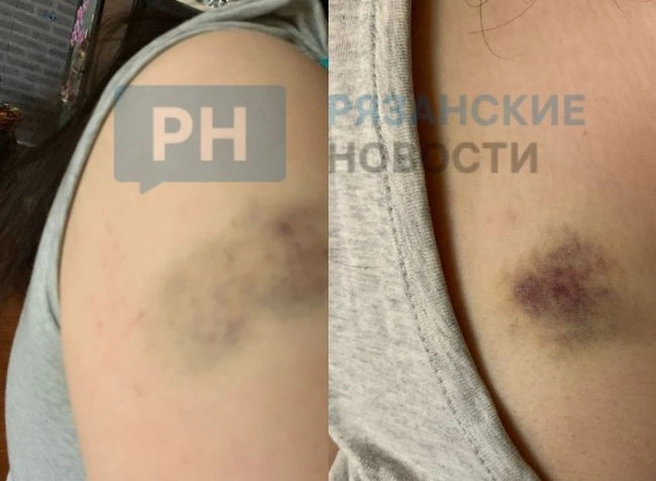 В общежитии РязГМУ избили студентку | ya62.ru