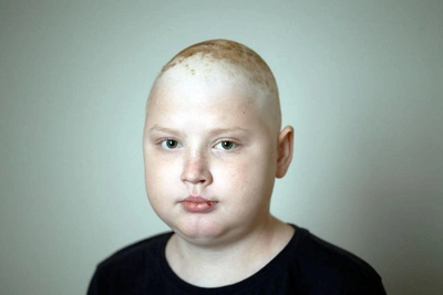 14-летнему Серёже срочно нужна протонная терапия