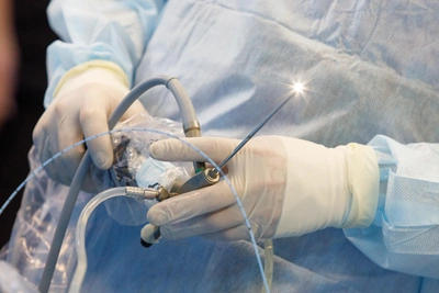 Иркутские врачи спасли пациентку с камнями в протоках