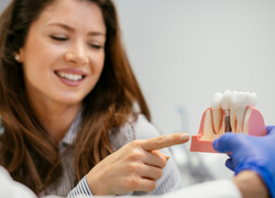 Мифы и правда об имплантации зубов