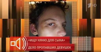 На лице и теле Анны было множество синяков | Источник: «Пусть говорят» / Первый канал