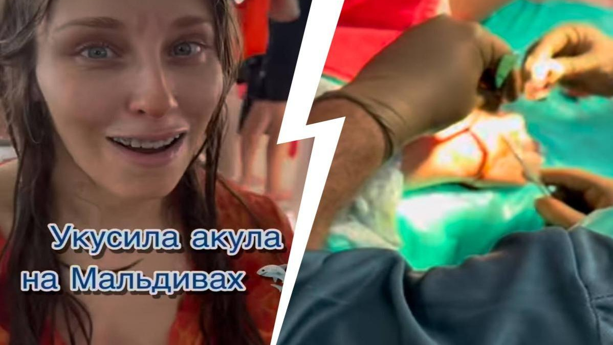 «Врачи рассказали о трёх летальных случаях»: на Мальдивах акула напала на стоматолога из Москвы