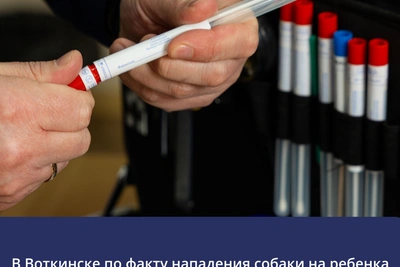 СК завел дело после нападения собаки на девочку в Воткинске