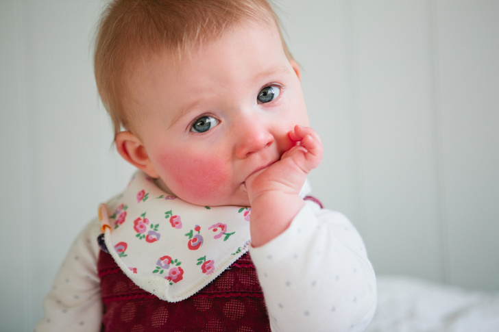 8 причин, почему у ребенка краснеют щеки