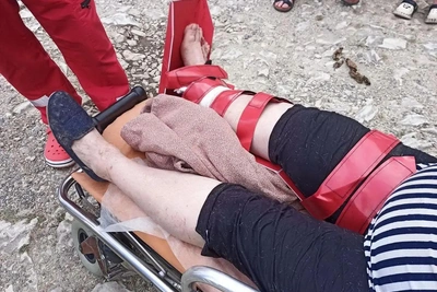 Сочинка сломала ногу после падения в реку Мацесту