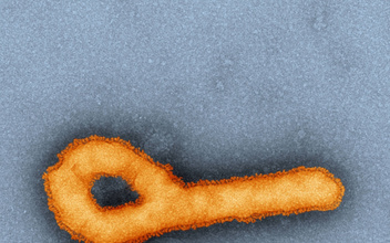 В России разработали новую вакцину против лихорадки Эбола