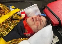 Рэпер Vacio выпал с третьего этажа в Париже — он в реанимации, состояние критическое