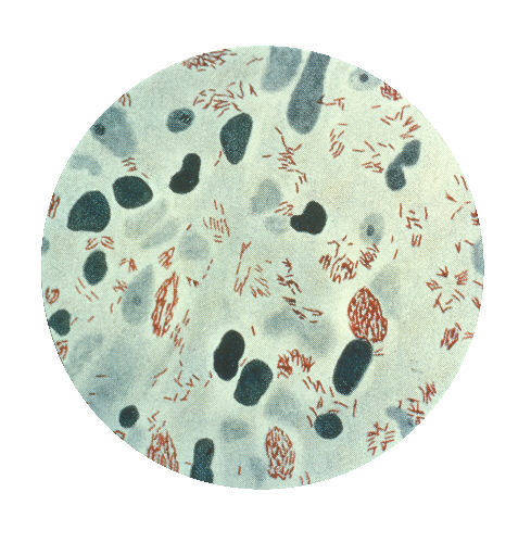 CDC / wikipedia.org
