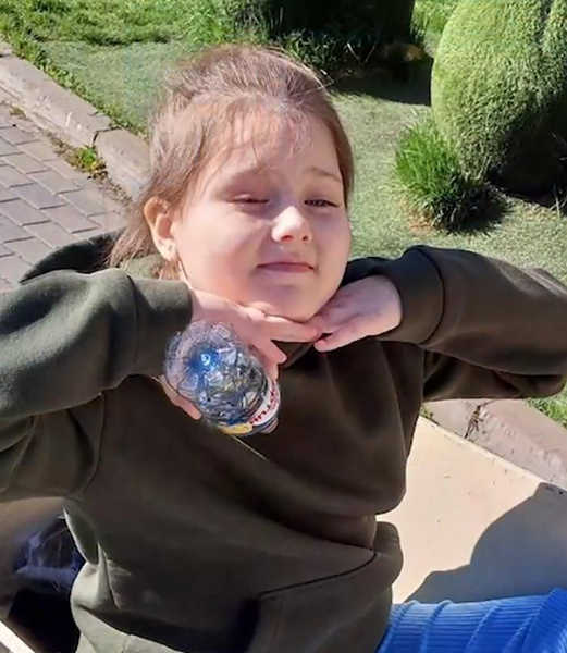 Новосибирские врачи спасли 8-летнюю девочку, страдавшую от 100 приступов эпилепсии в день