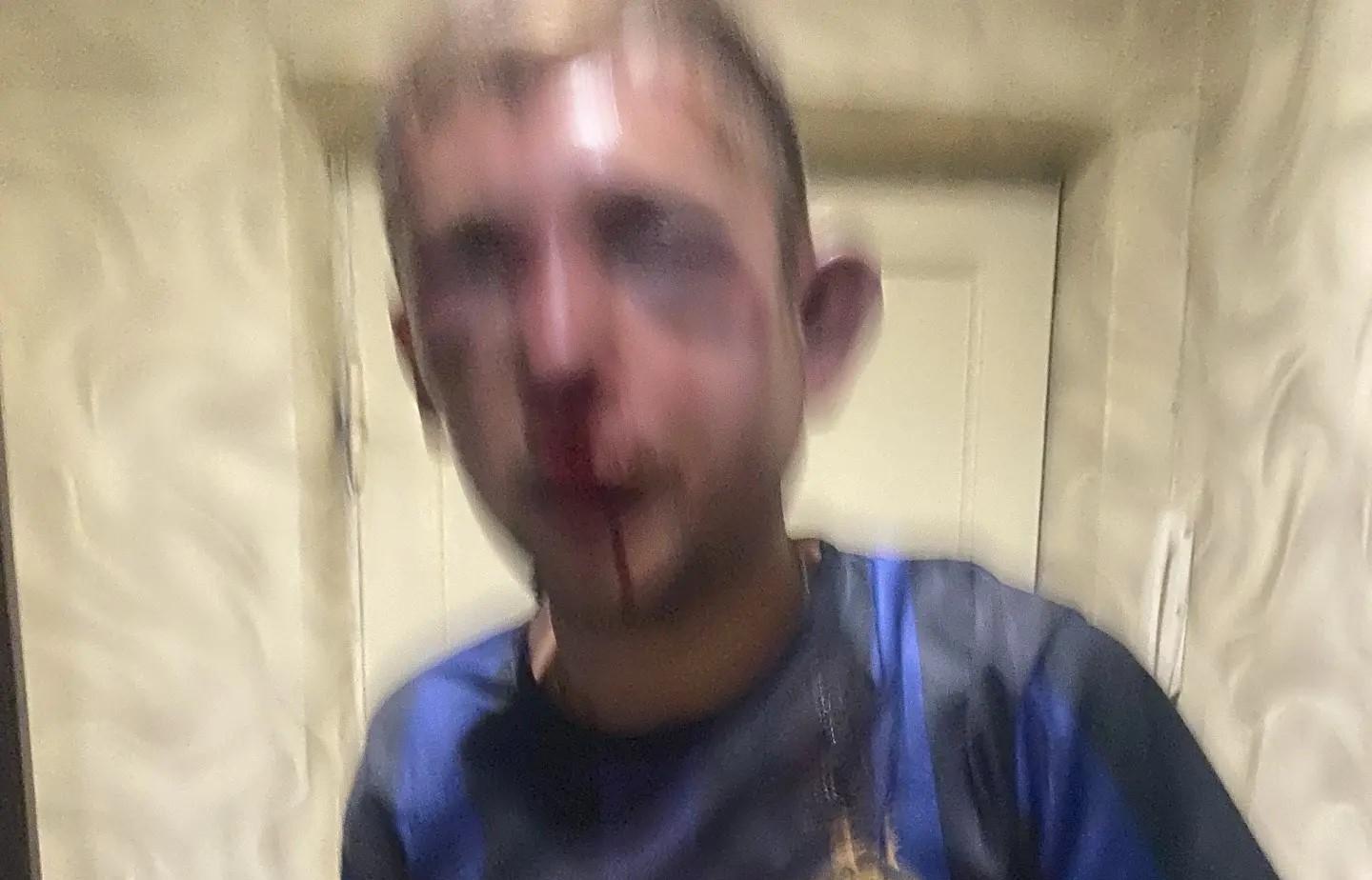 На пляже Первого озера компания мужчин избила челябинца до потери сознания