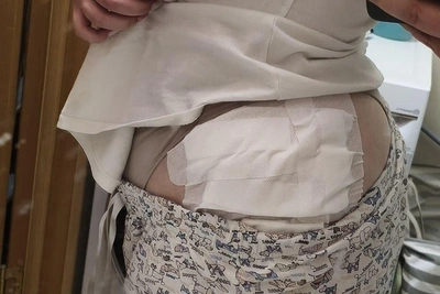 «Олимп» отверг обвинения в причинении ожога на картинге