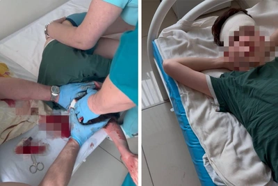 Пермячка обвиняет клинику в травме сына: падение с каталки после наркоза