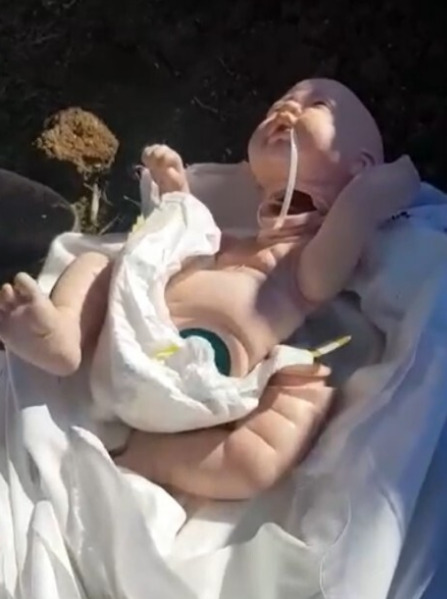 В Дагестане трупы малышей поменяли на кукол. Что говорят по этому поводу чиновники