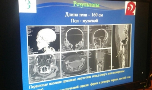 В Эрмитаже рассказали, как врачи поставили диагноз мумии из Египта