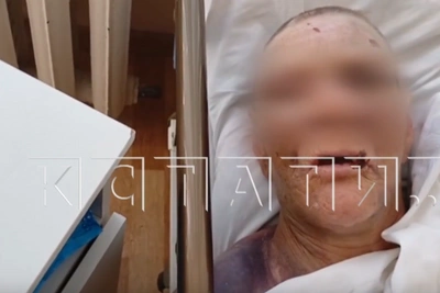 Пенсионерка умерла после жестокого нападения детей