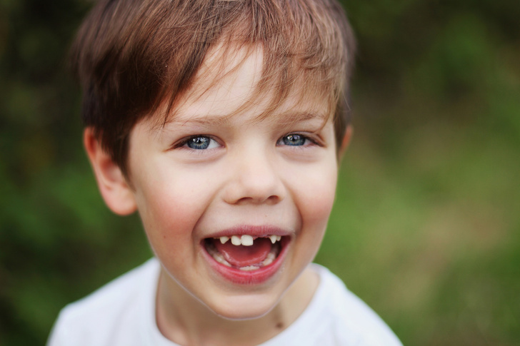 зубы, рано выпали молочные зубы, когда выпадают молочные зубы, детский стоматолог, что делать если выпали зубы