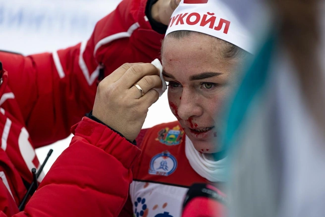 После финиша девушке оказали помощь  | Источник: Роман Федоров / T.me