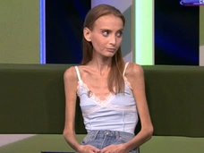 «Состояние критическое, в шаге от смерти»: 26-летняя Розалина из Татарстана весит 29 кило из-за диет