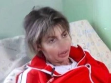 Когда Алиса Аршавина сможет восстановить изуродованное лицо? Разбор хирурга