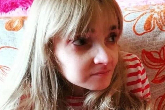 Результат реабилитации налицо | Источник: kikanakris / Instagram (запрещена на территории РФ)