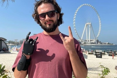 Yekaterinburg man shares his life with a cyber-prosthetic arm