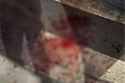 Подростка ранили ножом в спину в центре Петербурга