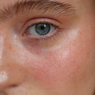 5 самых ужасных ошибок в уходе за кожей лица