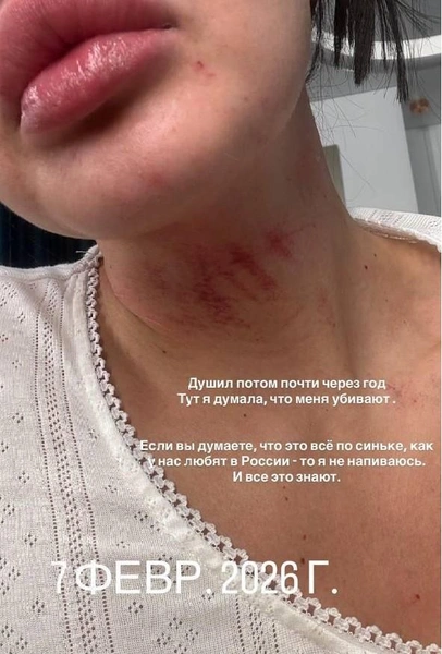 Источник: __angelna.g / instagram (экстремистская организация, деятельность запрещена на территории РФ)