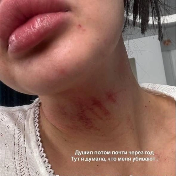 Источник: __angelna.g / instagram (экстремистская организация, деятельность запрещена на территории РФ)