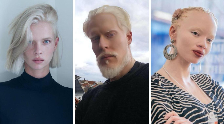 как выглядят самые знаменитые модели-альбиносы
