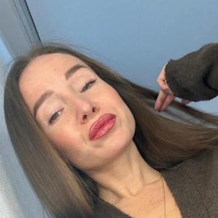 Алена Фоминых, которую изуродовали кислотой по наводке бывшего мужа, показала себя и впервые заговорила о трагедии