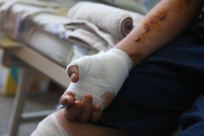 Шестилетний мальчик в Сочи пострадал от петарды