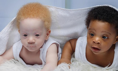 Как сейчас выглядят братья-близнецы с разным цветом кожи Дэвид и Дэниел