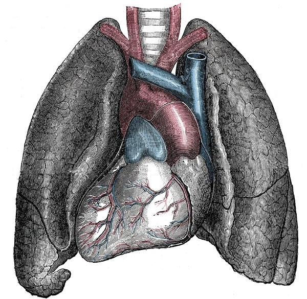 Situs viscerum inversus — зеркальное расположение внутренних органов | Источник: Angela at English Wikipedia., Public domain, via Wikimedia Commons