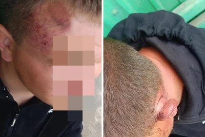 Нападение на бойца СВО в Кузбассе: возбуждено дело