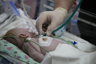 Бастрыкин взял на контроль дело о травмах младенца в Ставрополе